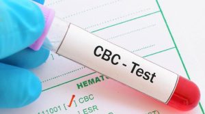 cbc-test