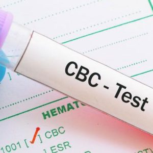 cbc-test