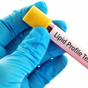 Lipid-profile