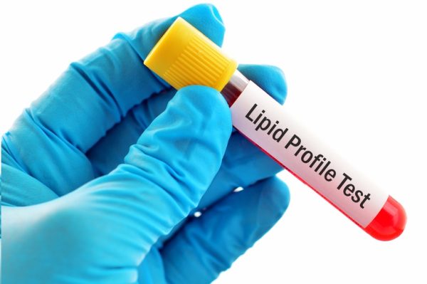 Lipid-profile