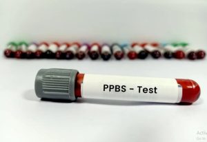 PPBS-Test