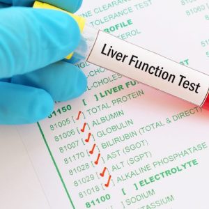 liver-function-test