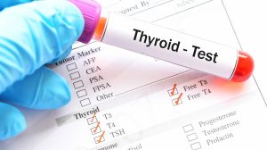 thyroid-profile