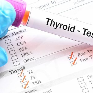 thyroid-profile