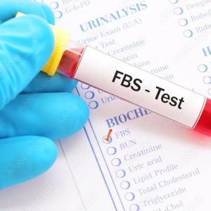 fasting blood sugar test